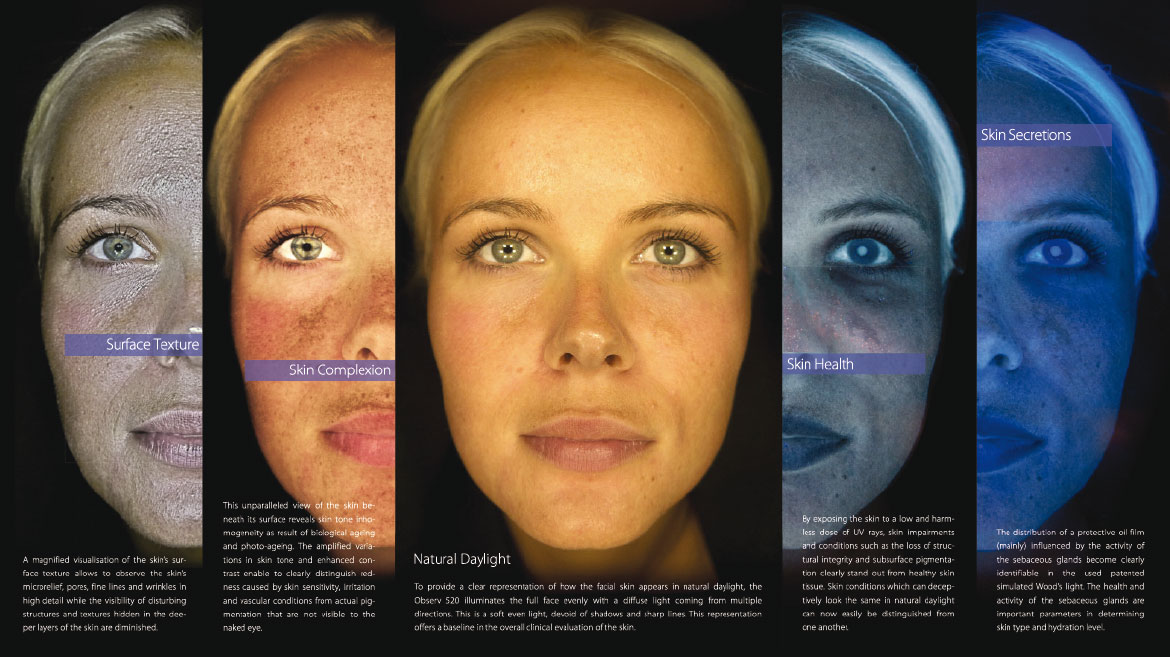 Atlantis Day Spa - Observ Facial Analysis